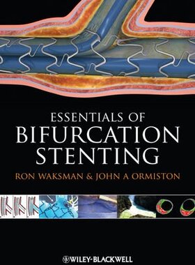 【预订】Bifurcation Stenting