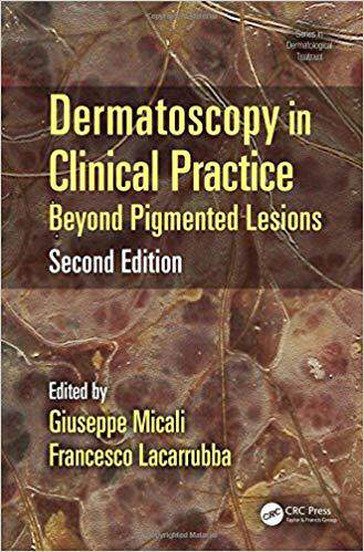 【预售】Dermatoscopy in Clinical Practice, Second Edition