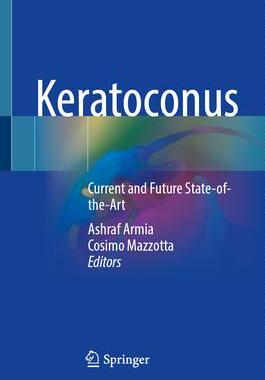 [预订]Keratoconus 9783030845056