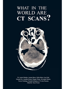 预订 What in the World are CT Scans?: 9781773692265