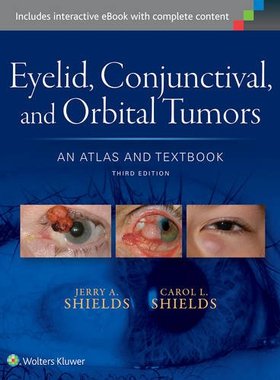 【预订】Eyelid; Conjunctival; and Orbital Tumors