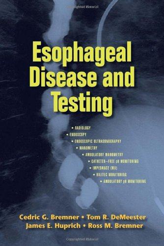 【预订】esophageal disease and testing