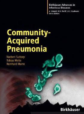 【预订】Community-Acquired Pneumonia