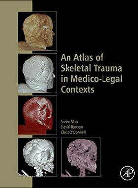 【预订】An Atlas of Skeletal Trauma in Medico-Legal Contexts