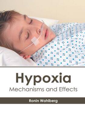 [预订]Hypoxia: Mechanisms and Effects 9781632418821