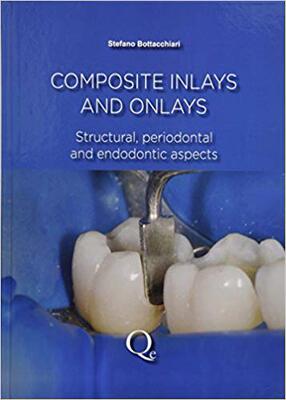 【预售】Composite Inlays and Onlays