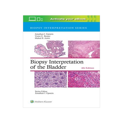 [预订]Biopsy Interpretation of the Bladder 9781975199203