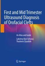 [预订]First and Mid Trimester Ultrasound Diagnosis of Orofacial Clefts 9789811646126