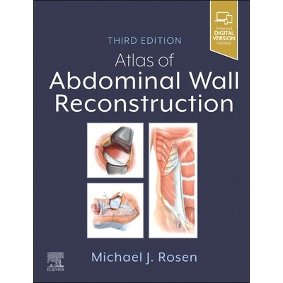 预订 Atlas of Abdominal Wall Reconstruction 腹壁重建图谱: 9780443118500
