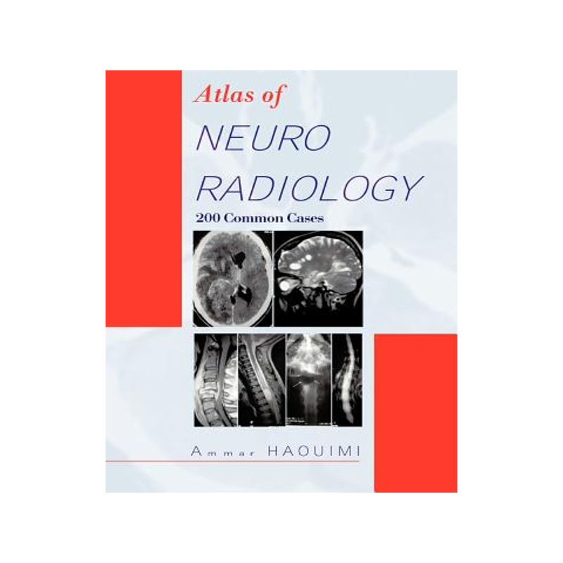 预订 Atlas of Neuroradiology: 200 Common Cases