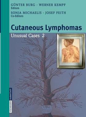【预订】Cutaneous Lymphomas