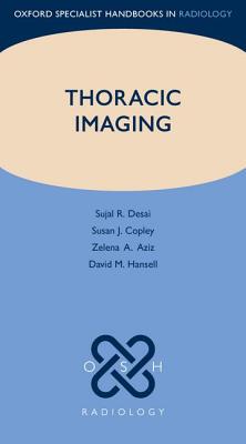 【预订】Thoracic Imaging