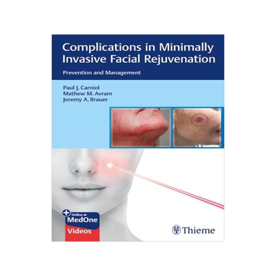 [预订]Complications in Minimally Invasive Facial Rejuvenation 9781684200139