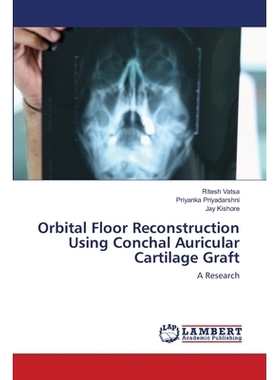 预订 Orbital Floor Reconstruction Using Conchal Auricular Cartilage Graft 耳壳软骨移植眼眶底重建: 9786202800556