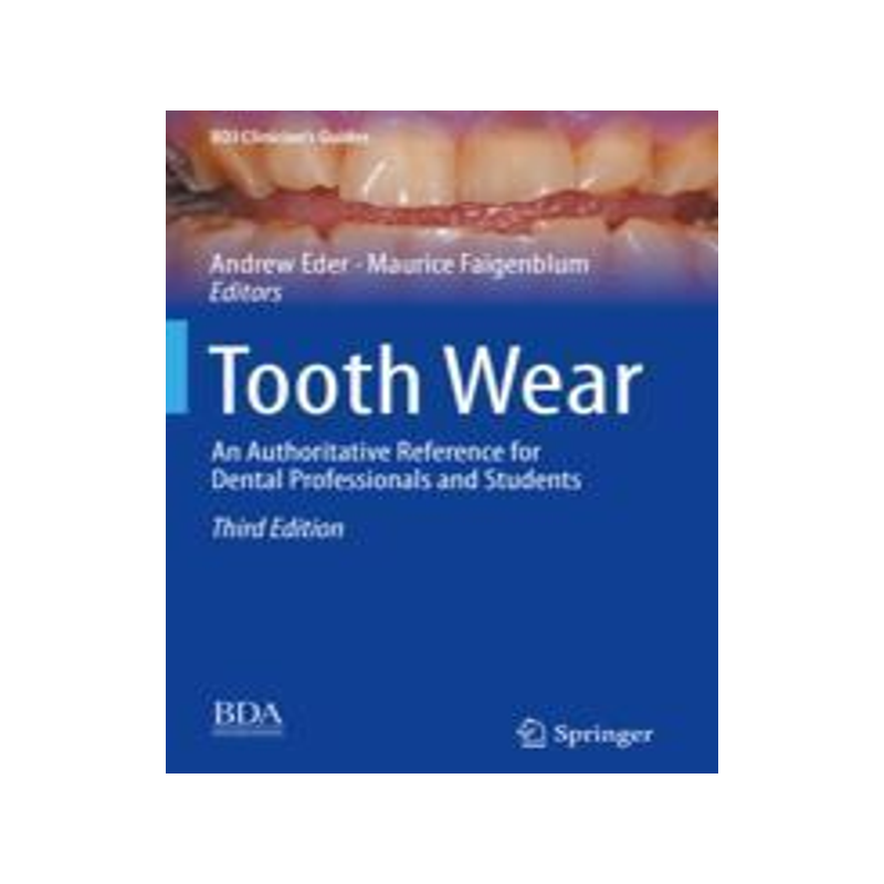 [预订]Tooth Wear: An Authoritative Reference for Dental Professionals and Students 9783030861124