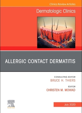 【预订】Allergic Contact Dermatitis, an Issue of Dermatologic Clinics, Volume 38-3
