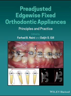 【预订】Preadjusted Edgewise Fixed Orthodontic Appliances 9781118817698