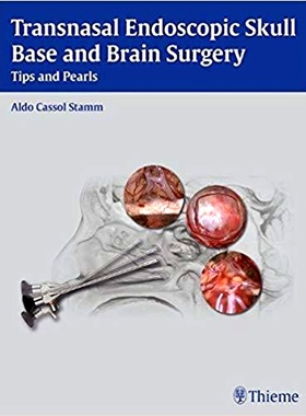 预订 Transnasal Endoscopic Skull Base and Brain Surgery: Tips and Pearls 经鼻内镜颅底和脑手术: 9781604063103