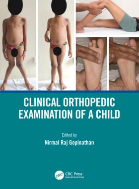 【预订】Clinical Orthopedic Examination of a Child 9780367001445