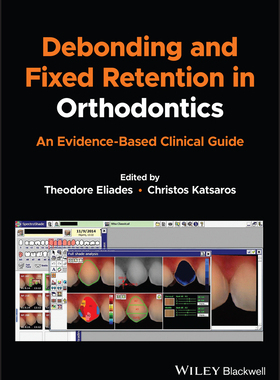 预订 Debonding and Fixed Retention in Orthodontics