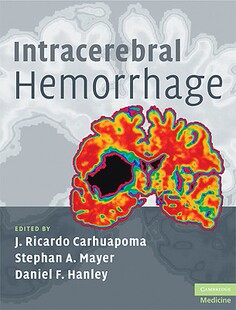 【预订】Intracerebral Hemorrhage
