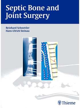 预订 Septic Bone and Joint Surgery 感染性骨关节外科: 9783131490315