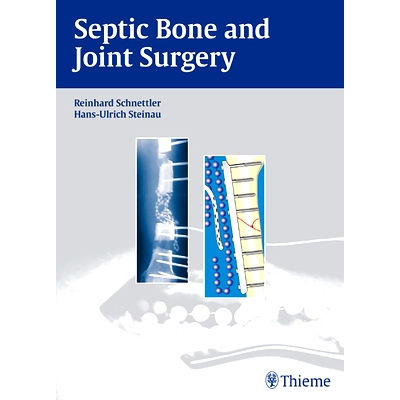 预订 Septic Bone and Joint Surgery 感染性骨关节外科: 9783131490315