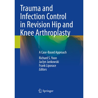 预订 Trauma and Infection Control in Revision Hip and Knee Arthroplasty A Case-Based Approach 人工髋膝关节翻修术的创伤与