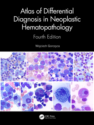 【预订】Atlas of Differential Diagnosis in Neoplastic Hematopathology 9780367637248