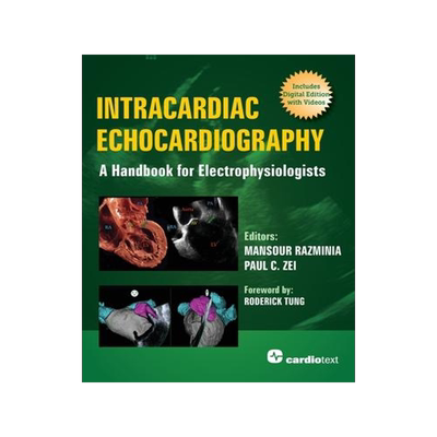 [预订]Intracardiac Echocardiography: A Handbook for Electrophysiologists 9781942909392