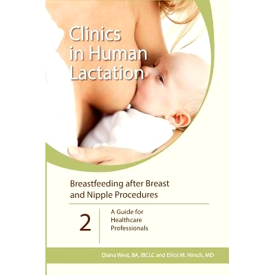 预订 Breastfeeding after Breast and Nipple Procedures: A Guide for Healthcare Professionals: 9781939807823
