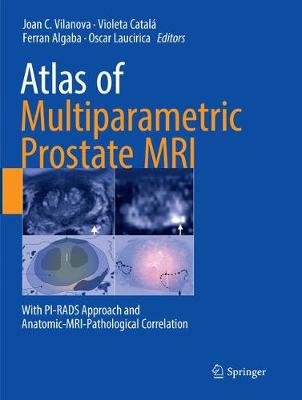 【预订】Atlas of Multiparametric Prostate MRI