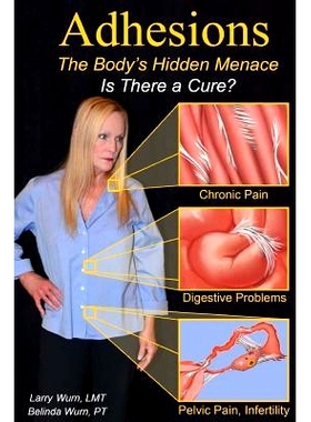 预订 Adhesions: The Body’s Inner Menace - Is There a Cure?: 9781986094788