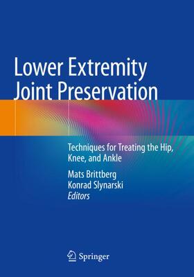 【预订】Lower Extremity Joint Preservation 9783030573843