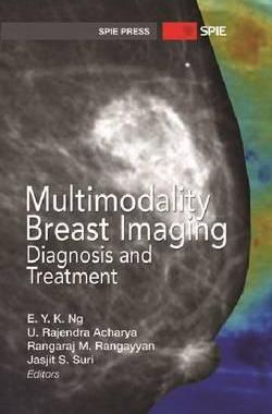 [预订]Multimodality Breast Imaging 9780819492944