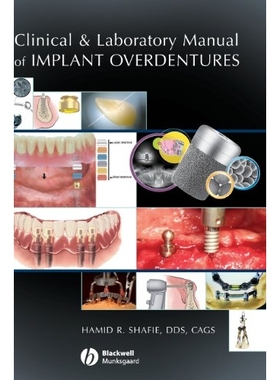 预订 Clinical and Laboratory Manual of Implant Overdentures Implant Overdentures 临床与实验手册: 9780813808819