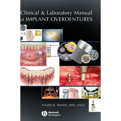 预订 Clinical and Laboratory Manual of Implant Overdentures Implant Overdentures 临床与实验手册: 9780813808819