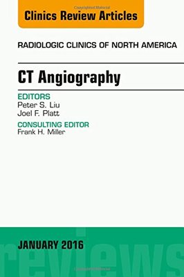【预订】CT Angiography, An Issue of Radiologic Clinics of North America