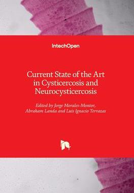 [预订]Current State of the Art in Cysticercosis and Neurocysticercosis 9781839693946