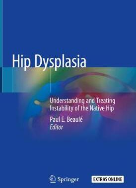 【预订】Hip Dysplasia