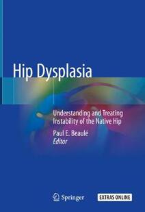 【预订】Hip Dysplasia