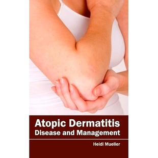 预订 A*ic Dermatitis: Disease and Management 特应性皮炎:疾病与管理: 9781632420589