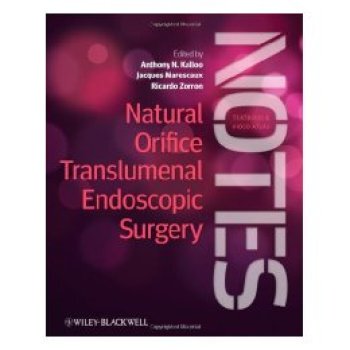 【预订】Natural Orifice Translumenal Endoscopic Surgery (Notes) - Textbook and Video Atlas