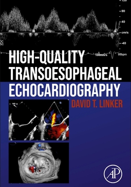 【预订】High-Quality Transesophageal Echocardiography 9780128229323