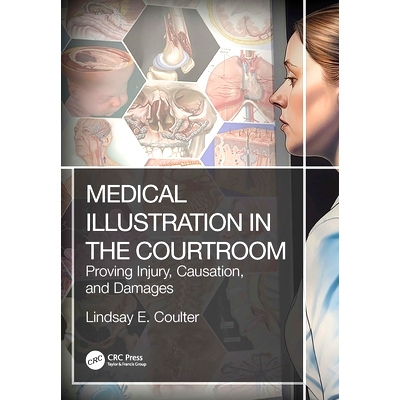 Proving Injury, Causation, and Damages