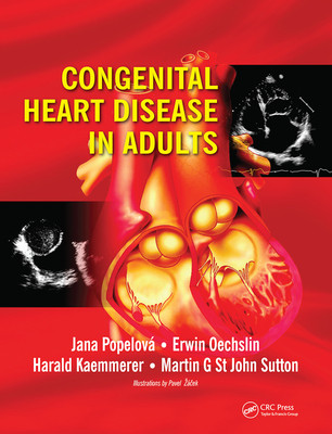 【预订】Congenital Heart Disease in Adults