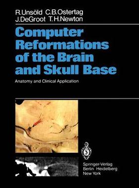 【预订】Computer Reformations of the Brain and Skull Base