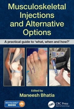 【预订】Musculoskeletal Injections and Alternative Options 9780815355540