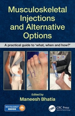 【预订】Musculoskeletal Injections and Alternative Options 9780815355540