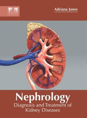 [预订]Nephrology: Diagnosis and Treatment of Kidney Diseases 9781632429643